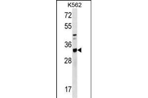 TIPRL Antibody (C-term) (ABIN1536814 and ABIN2849644) western blot analysis in K562 cell line lysates (35 μg/lane). (TIPRL Antikörper  (C-Term))