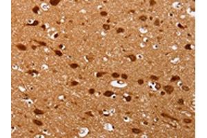 The image on the left is immunohistochemistry of paraffin-embedded Human brain tissue using ABIN7130740(PSMD3 Antibody) at dilution 1/25, on the right is treated with fusion protein. (PSMD3 Antikörper)