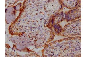IHC image of ABIN7127339 diluted at 1:100 and staining in paraffin-embedded human placenta tissue performed on a Leica BondTM system. (Rekombinanter Angiopoietin 2 Antikörper)