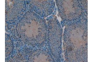 IHC-P analysis of Mouse Testis Tissue, with DAB staining. (RELB Antikörper  (AA 176-436))