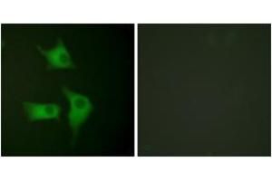 Immunofluorescence analysis of HeLa cells, using p15 INK Antibody. (CDKN2B Antikörper  (AA 89-138))