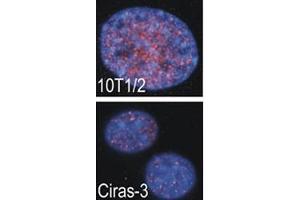 Indirect IF analysis showed that RSKB is localized in the nucleus of parental (10T1/2) and oncogene-transformed (Ciras-3) mouse fibroblasts (MSK2 Antikörper  (AA 322-354))
