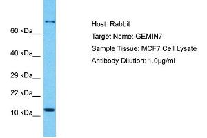 Host: Rabbit Target Name: GEMIN7 Sample Type: MCF7 Whole Cell lysates Antibody Dilution: 1. (GEMIN7 Antikörper  (N-Term))