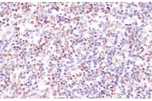 Immunohistochemistry of paraffin-embedded Human lymph node using CREB1 Polyclonal Antibody at dilution of 1:100 (40x lens). (CREB1 Antikörper)