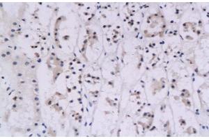 Immunohistochemistry (IHC) image for anti-Interferon gamma (IFNG) (AA 81-166) antibody (ABIN669141) (Interferon gamma Antikörper  (AA 81-166))