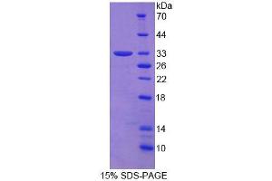Image no. 1 for 2',5'-Oligoadenylate Synthetase 1, 40/46kDa (OAS1) (AA 139-358) protein (His tag) (ABIN6236903)
