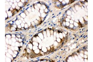 Immunohistochemistry (IHC) image for anti-Fatty Acid Binding Protein 1, Liver (FABP1) (AA 6-36), (N-Term) antibody (ABIN3042384)