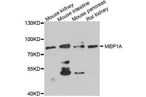Western blot analysis of extract of various cells, using MEP1A antibody. (MEP1A Antikörper)