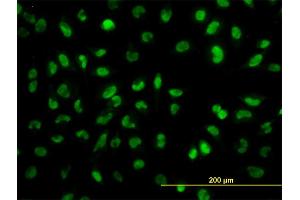 Immunofluorescence of monoclonal antibody to SNAI2 on HeLa cell. (SLUG Antikörper  (AA 97-169))