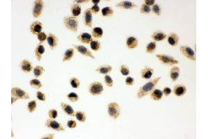 IHC analysis of Peroxiredoxin 3 using anti-Peroxiredoxin 3 antibody . (Peroxiredoxin 3 Antikörper  (AA 110-256))