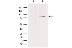 Western blot analysis of extracts from HepG2, using TRI18 Antibody. (MID1 Antikörper  (N-Term))