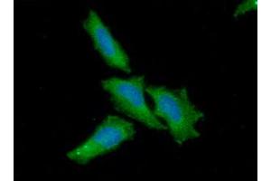 ICC/IF analysis of NFATc1 in HaLe cells.