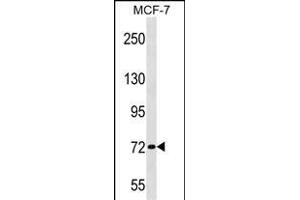 ZN Antibody (Center) (ABIN1538115 and ABIN2848690) western blot analysis in MCF-7 cell line lysates (35 μg/lane). (ZNF408 Antikörper  (AA 223-251))