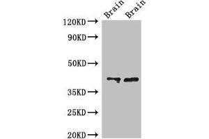 Western Blot Positive WB detected in: Rat brain tissue, Mouse brain tissue All lanes: CAMK1 antibody at 3 μg/mL Secondary Goat polyclonal to rabbit IgG at 1/50000 dilution Predicted band size: 42 kDa Observed band size: 42 kDa (CAMK1 Antikörper  (AA 166-265))