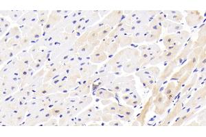 Detection of IL1RAPL1 in Human Cardiac Muscle Tissue using Polyclonal Antibody to Interleukin 1 Receptor Accessory Protein Like Protein 1 (IL1RAPL1) (IL1RAPL1 Antikörper  (AA 113-276))