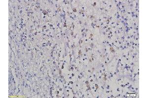 Formalin-fixed and paraffin embedded rat intestine labeled with Anti HOXB8 Polyclonal Antibody, Unconjugated  followed by conjugation to the secondary antibody and DAB staining
