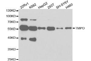 Western blot analysis of extracts of various cell lines, using TMPO antibody (ABIN5971365) at 1/1000 dilution. (Thymopoietin Antikörper)