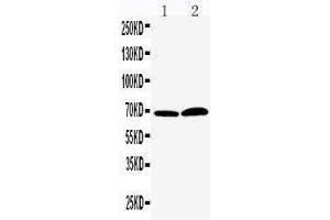 Anti-PADI4/PAD4 antibody, Western blotting Lane 1: PANC Cell Lysate Lane 2: 293T Cell Lysate (PAD4 Antikörper  (Middle Region))