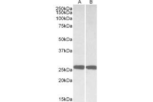 AP21291PU-N UCHL1 antibody staining of Mouse (A) and Rat (B) Brain lysates at 0. (UCHL1 Antikörper  (Internal Region))
