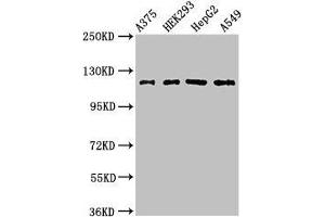 Western Blot Positive WB detected in: A375 whole cell lysate, HEK293 whole cell lysate, HepG2 whole cell lysate, A549 whole cell lysate All lanes: FARP1 antibody at 3 μg/mL Secondary Goat polyclonal to rabbit IgG at 1/50000 dilution Predicted band size: 119, 123, 15 kDa Observed band size: 119 kDa (FARP1 Antikörper  (AA 1-300))