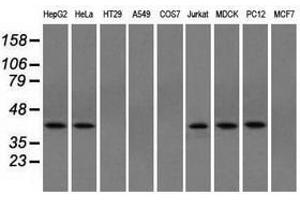 Image no. 4 for anti-Acetyl-CoA Acetyltransferase 2 (ACAT2) antibody (ABIN1496402) (ACAT2 Antikörper)
