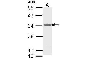 WB Image Sample (30 ug of whole cell lysate) A: Molt-4 , 12% SDS PAGE antibody diluted at 1:1000 (THO Complex 4 Antikörper)