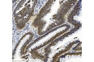 IHC analysis of SMAD2 using anti-SMAD2 antibody (ABIN7602542). (SMAD2 Antikörper  (AA 83-264))