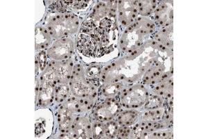 Immunohistochemical staining (Formalin-fixed paraffin-embedded sections) of human kidney with KPNA6 polyclonal antibody  shows strong nuclear positivity in cells in tubules and cells in glomeruli. (KPNA6 Antikörper)