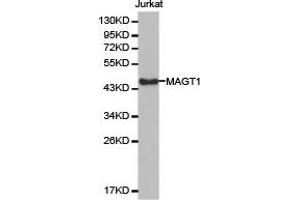 Western Blotting (WB) image for anti-Magnesium Transporter 1 (MAGT1) antibody (ABIN1876277) (MAGT1 Antikörper)