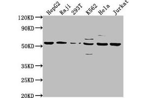 Western Blot Positive WB detected in: HepG2 whole cell lysate, Raji whole cell lysate, 293T whole cell lysate, K562 whole cell lysate, Hela whole cell lysate, Jurkat whole cell lysate All lanes: CAP1 antibody at 1:2000 Secondary Goat polyclonal to rabbit IgG at 1/50000 dilution Predicted band size: 52 kDa Observed band size: 52 kDa (CAP1 Antikörper  (AA 22-157))
