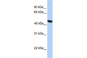 WB Suggested Anti-MSL3L2 Antibody Titration:  0. (MSL3L2 Antikörper  (Middle Region))