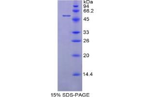 SDS-PAGE analysis of Cow LBP Protein. (LBP Protein)