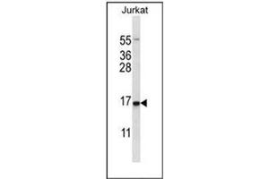 Western blot analysis of GADD153 / CHOP Antibody  in Jurkat cell line lysates (35ug/lane). (DDIT3 Antikörper  (Middle Region))