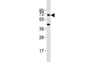 Western blot testing of TGFBR2 antibody at 1:2000 dilution + mouse lung lysate; Predicted molecular weight ~ 65 kDa. (TGFBR2 Antikörper  (AA 13-40))
