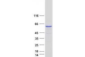 UDP-N-Acteylglucosamine Pyrophosphorylase 1-Like 1 (UAP1L1) protein (Myc-DYKDDDDK Tag)