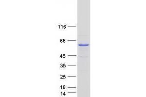 Validation with Western Blot (UAP1L1 Protein (Myc-DYKDDDDK Tag))