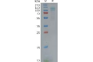 SDS-PAGE (SDS) image for Egf-Like Module Containing, Mucin-Like, Hormone Receptor-Like 1 (EMR1) (AA 21-599) protein (His tag) (ABIN7092778)