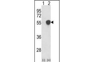 Western blot analysis of PHGDH (arrow) using rabbit polyclonal PHGDH Antibody (N-term) (ABIN389483 and ABIN2839543). (PHGDH Antikörper  (N-Term))