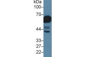 Detection of CK5 in Rat Tongue lysate using Polyclonal Antibody to Cytokeratin 5 (CK5) (Cytokeratin 5 Antikörper  (AA 163-471))