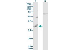 Western Blot analysis of CAPS2 expression in transfected 293T cell line by CAPS2 monoclonal antibody (M02), clone 3C6. (Calcyphosine 2 Antikörper  (AA 285-382))