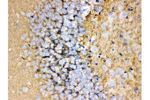 Anti-GAP43 antibody, IHC(P) IHC(P): Rat Brain Tissue (GAP43 Antikörper  (C-Term))