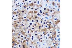 Immunohistochemistry (IHC) image for anti-Protein Phosphatase 1, Catalytic Subunit, beta Isoform (PPP1CB) (AA 1-327) antibody (ABIN3021409)