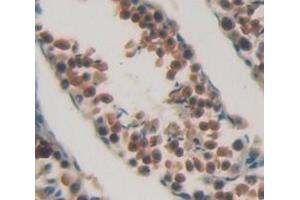 Figure. (CHEK1 Antikörper  (AA 194-446))