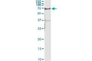 ALPPL2 (Human) IP-WB Antibody Pair