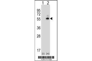 Western blot analysis of Camk2d using rabbit polyclonal Mouse Camk2d Antibody using 293 cell lysates (2 ug/lane) either nontransfected (Lane 1) or transiently transfected (Lane 2) with the Camk2d gene. (CAMK2D Antikörper  (AA 221-250))