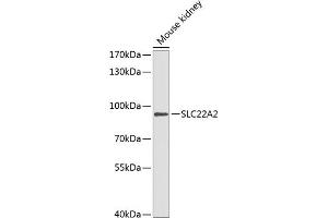 Western blot analysis of extracts of mouse kidney, using SLC22 antibody (ABIN6129479, ABIN6147886, ABIN6147888 and ABIN6218288) at 1:1000 dilution. (SLC22A2 Antikörper  (AA 44-140))