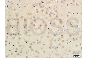 Formalin-fixed and paraffin embedded rat brain tissue labeled with Anti-PITX3 Polyclonal Antibody (ABIN679988) , Unconjugated at 1:200 followed by conjugation to the secondary antibody (PITX3 Antikörper  (AA 231-302))