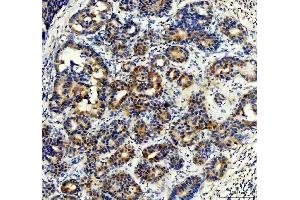 IHC analysis of Synip/STXBP4 using anti-Synip/STXBP4 antibody (ABIN7602066). (STXBP4 Antikörper  (AA 57-481))