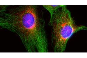 Immunocytochemistry (ICC) image for anti-Golgi SNAP Receptor Complex Member 2 (GOSR2) (AA 2-190), (Cytoplasmic Domain) antibody (ABIN1742357)