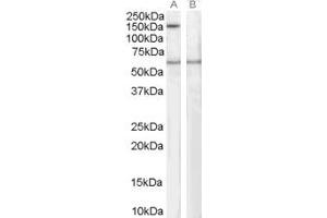Western Blotting (WB) image for anti-Signal-Induced Proliferation-Associated 1 (SIPA1) (C-Term) antibody (ABIN2466269) (SIPA1 Antikörper  (C-Term))